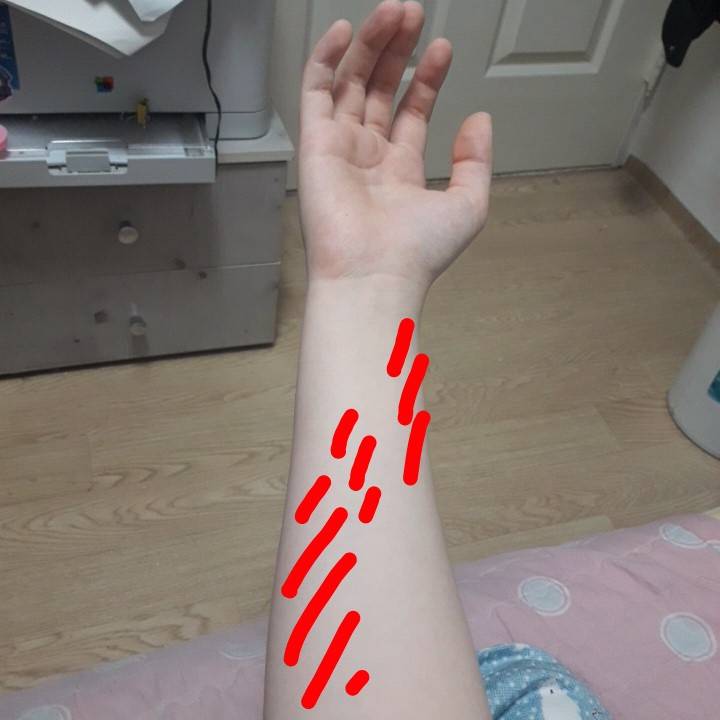 갑자기 팔이 아파 | 인스티즈