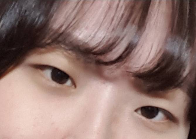 이런 눈 쌍수 할까 말까 | 인스티즈