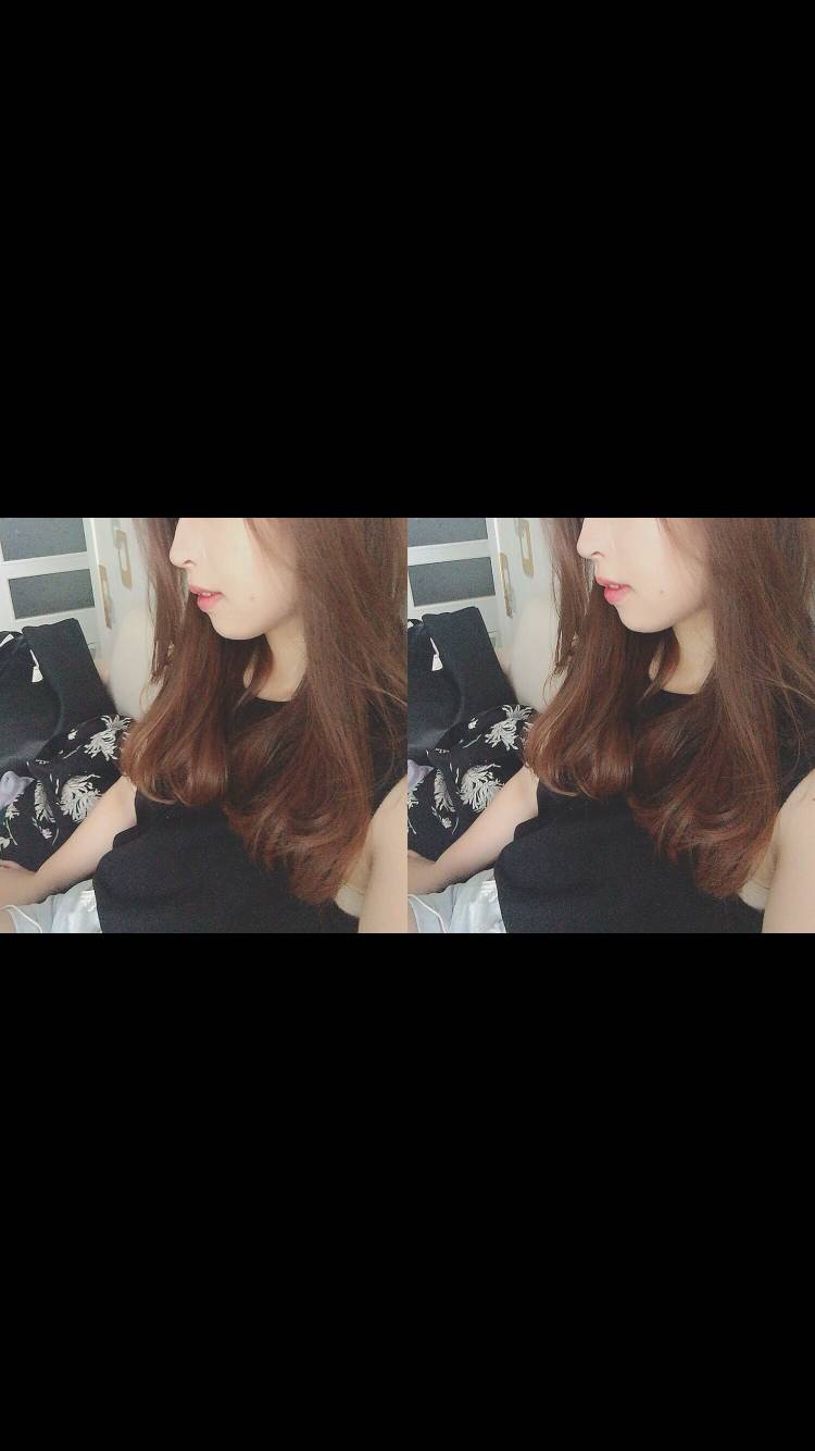 익들아..혹시 나 무턱이니..?ㅠㅠㅠㅠ | 인스티즈