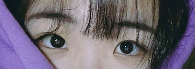 나 앞트임 할까말까 | 인스티즈