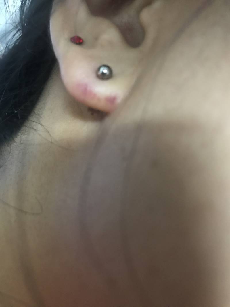 귀를 뚫었는데 왜 이럴까? | 인스티즈