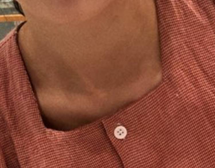 나의 쇄 골 보 고 가 | 인스티즈