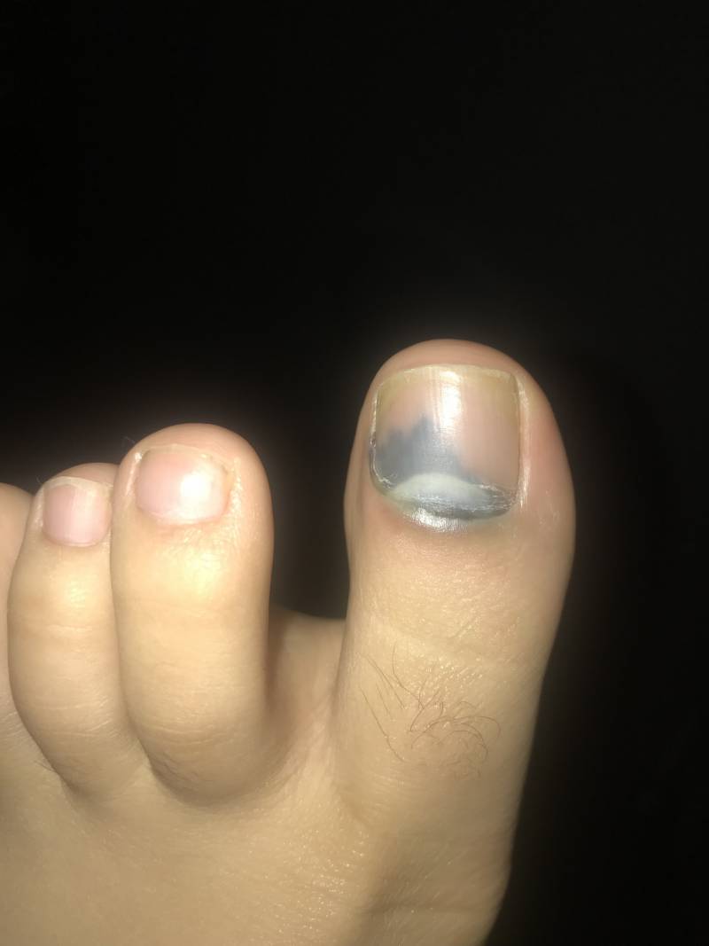 발톱에 청소기 떨어뜨렸는데 (ㅎㅇㅈㅇ) | 인스티즈