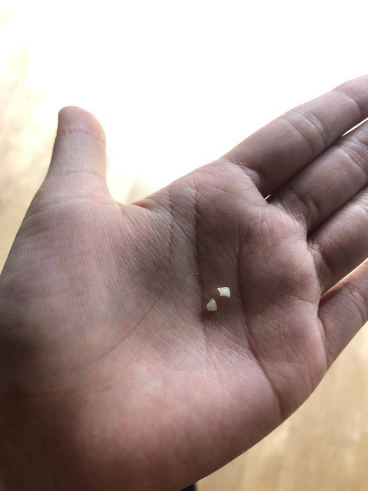 나익 이 깨졌는데 | 인스티즈