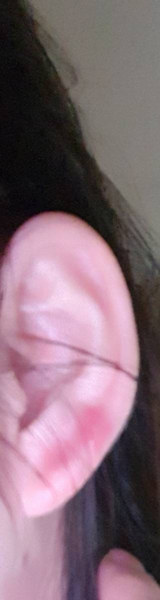 귓볼에 이거 뭔지 아는익 ㅜㅜㅠㅜㅡㅠ (약 ㅎㅇㅈㅇ) | 인스티즈