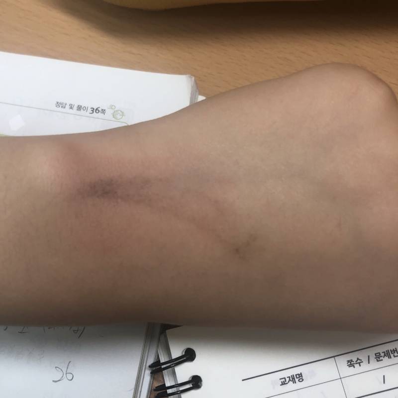 손등에 이마 대고 잠들었는데ㅋㅌㅋㅋㅋㅋㅋ 40 | 인스티즈