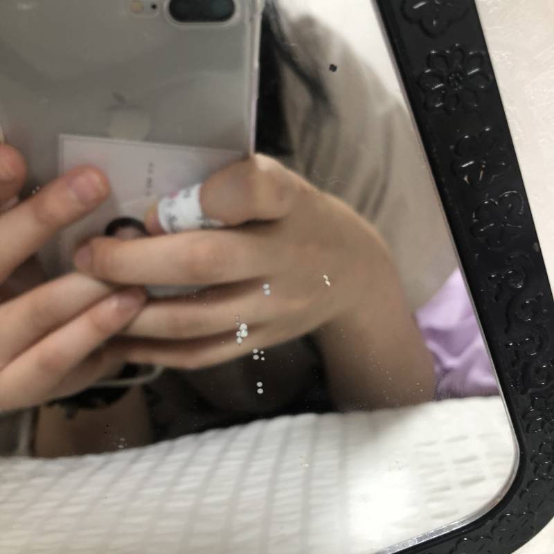 ㄴㅐ 여드름 짠거 튐 | 인스티즈