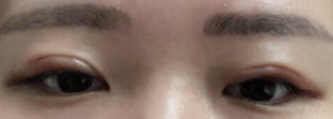 익들아 내 눈 왜이래... 급해 ㅠㅠㅠ | 인스티즈