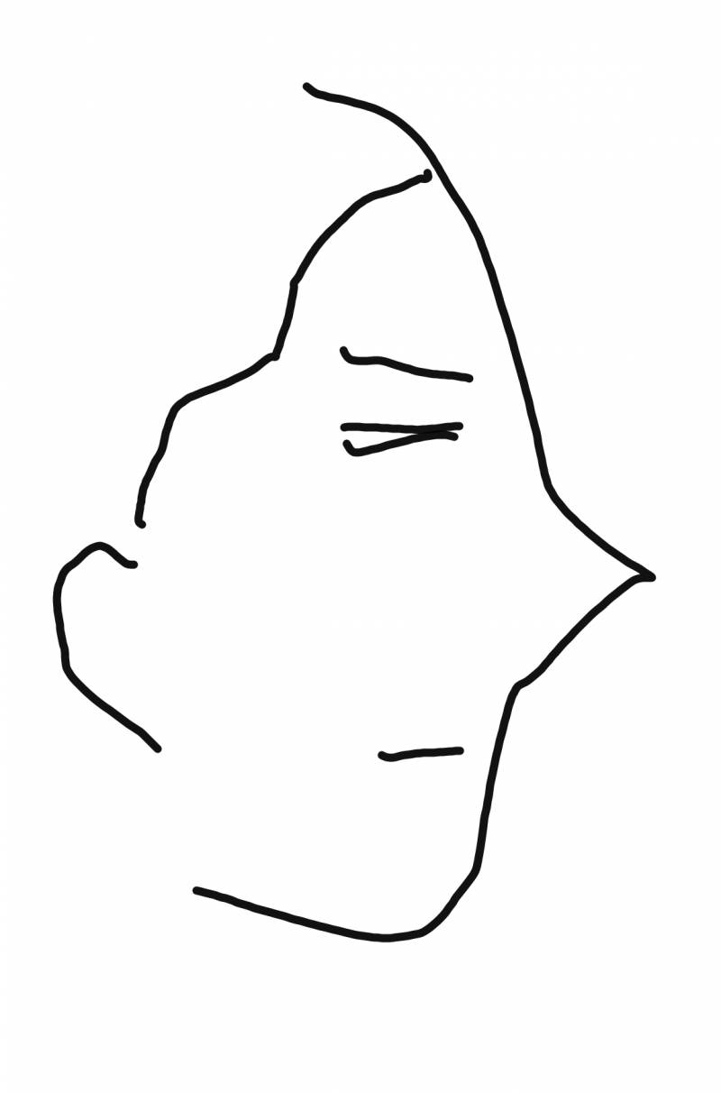 헤어라인 이렇게 생긴거 너무 스트레스야ㅠㅠ 고칠 수 있을까? - 인스티즈(instiz) 뷰티 카테고리