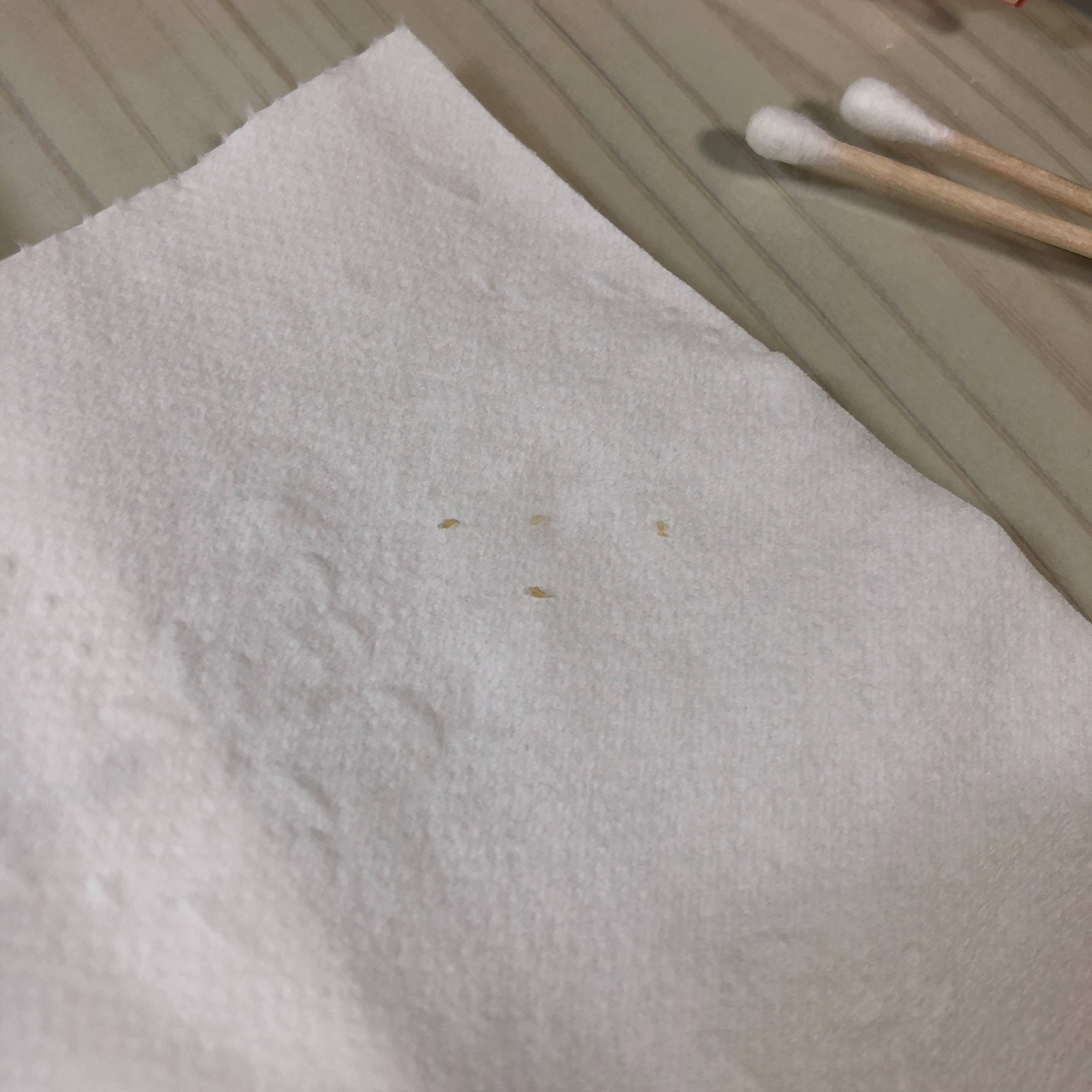 묵은 피지 짰다 40 | 인스티즈