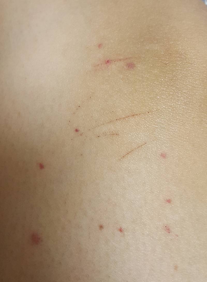 내다리에 갑자기 빨간 점들이 생기고있는데 너무무서워 이거 뭘까ㅠㅠ | 인스티즈