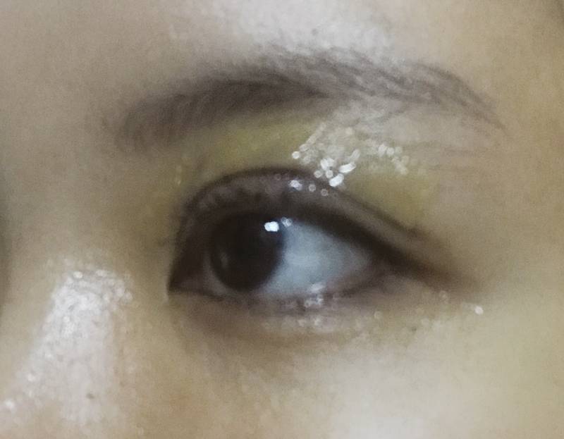 쌍수햇는데 라인 마음에 든댱(혐오주의) | 인스티즈