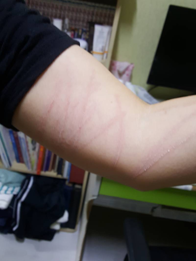 강아지 산책 시키다 쌈났는데 | 인스티즈