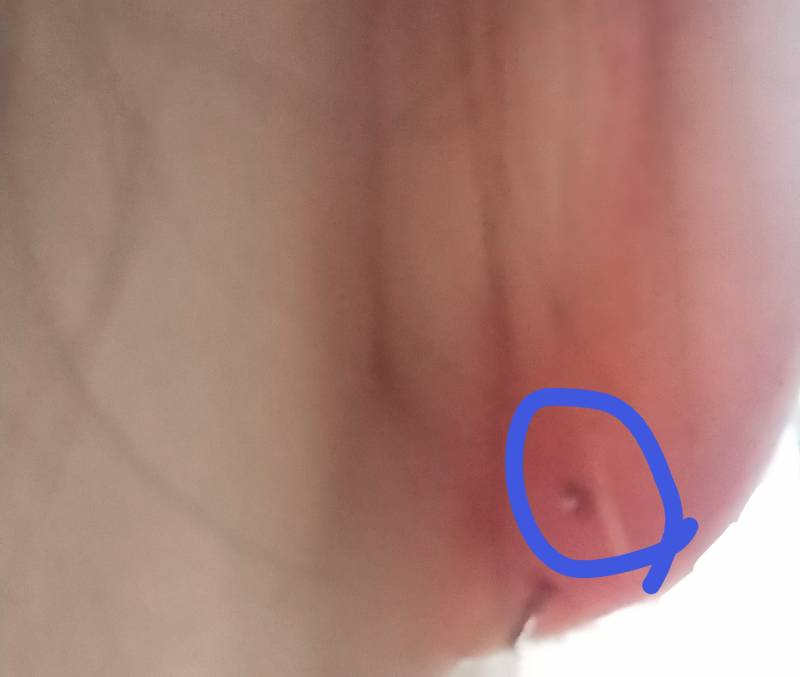 익들 이 귀걸이 갈아야 하겎지?ㅠ | 인스티즈