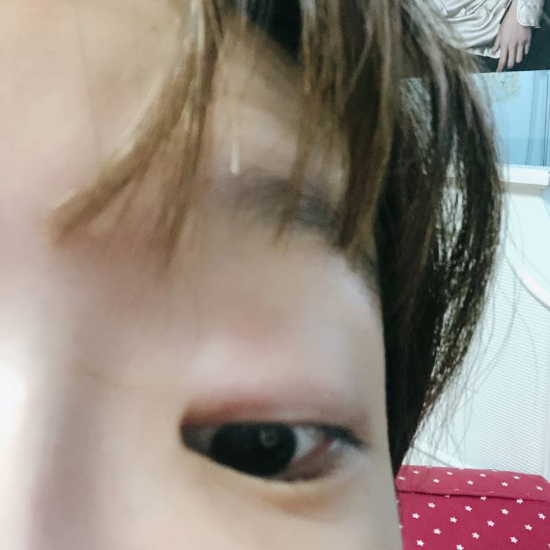 이거 다래낀가..? | 인스티즈