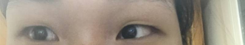 내 눈 이런데ㅜㅜㅜㅜㅜ쌍액하면 자리 잡으려나 | 인스티즈