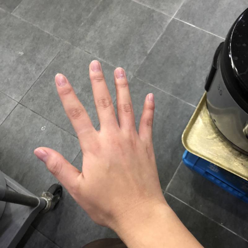 이런 화상은 어떻게 해????? | 인스티즈