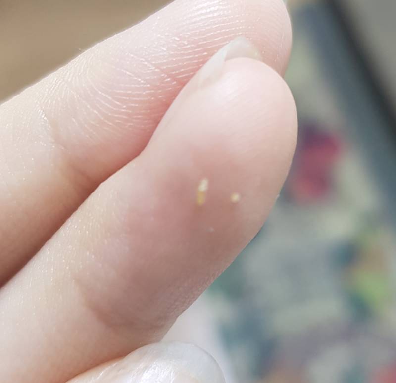 코에서 피지 큰거 나왔다(더러움주의 | 인스티즈