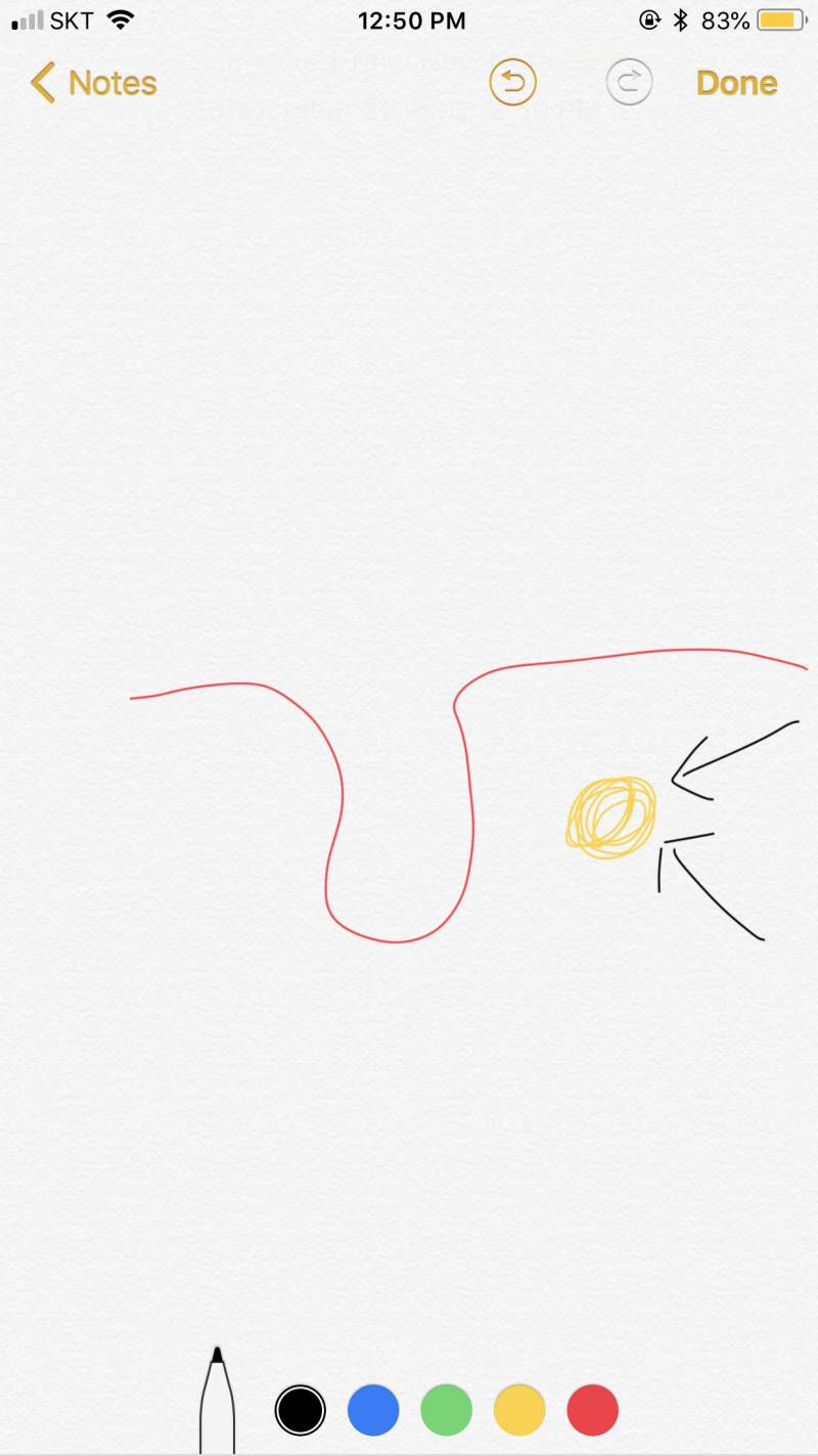 와 나 편도결석 진짜 1초만에 빼는 법 알아냈어(혐오주의) | 인스티즈