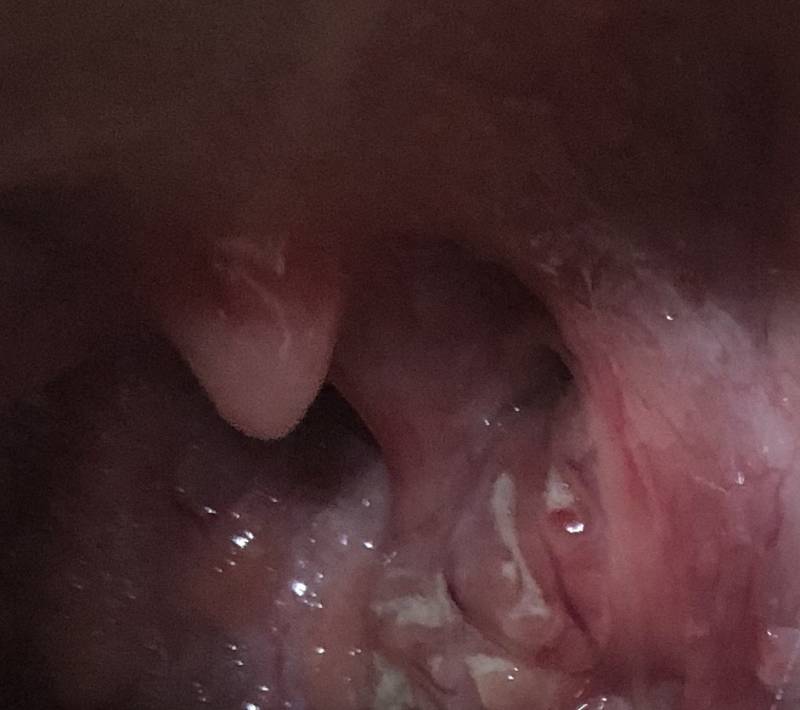 목에 이거있는데 뭔지아는 사람 ㅠㅎㅇㅈㅇ | 인스티즈