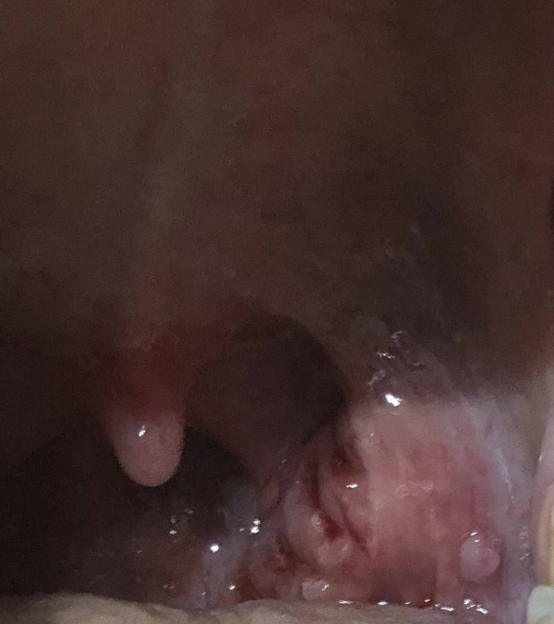 목에 이거있는데 뭔지아는 사람 ㅠㅎㅇㅈㅇ | 인스티즈