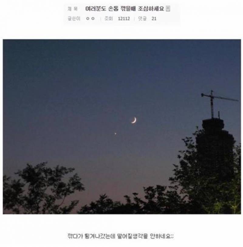 다들 손톱 깎을때 조심해 ..ㅠ | 인스티즈