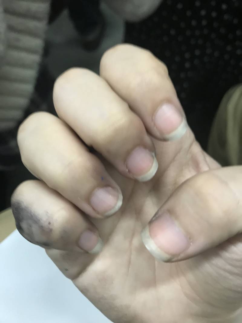 나 왜이렇게 손톱이 건강하지 않을까 40 | 인스티즈