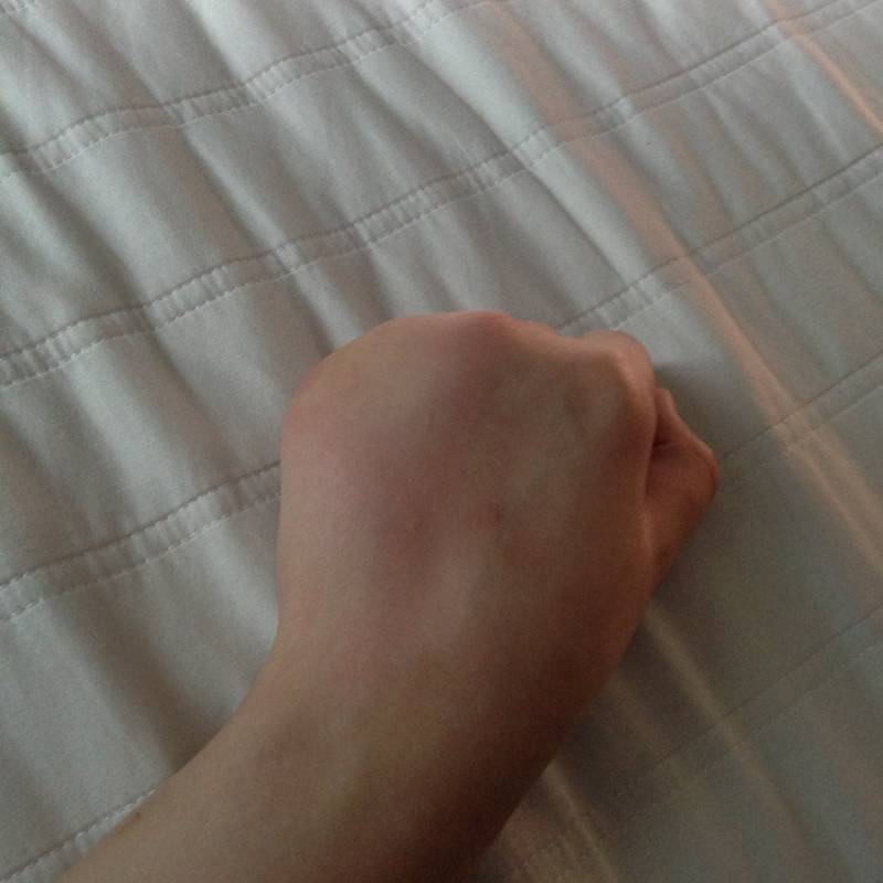 와 손등에 벌레 물렸는데 도라에몽 손 됨ㅋㅋㅋㅋㅋㅋ | 인스티즈