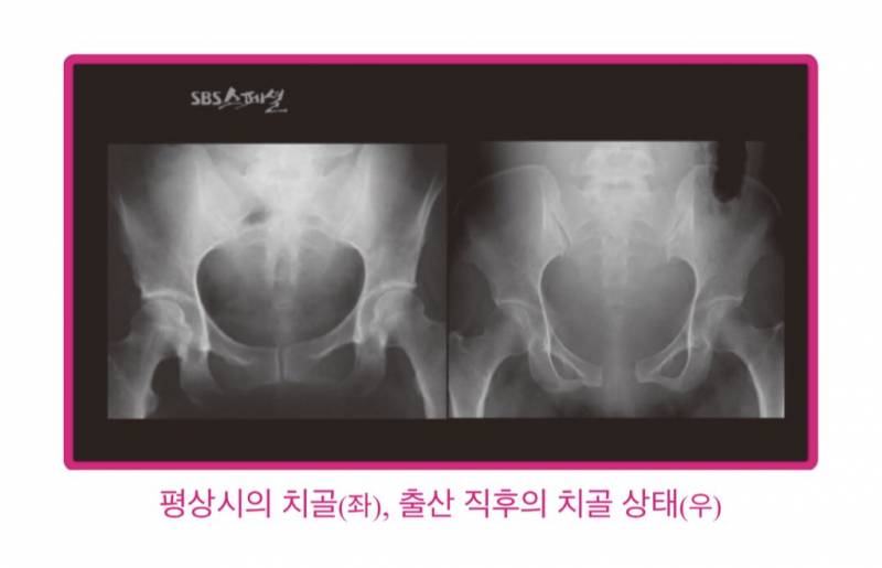 나 출산예정일 한달남아서 이것저것 다 찾아보고있는데 | 인스티즈