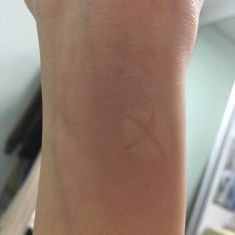 아직도 모기가 있어?? | 인스티즈