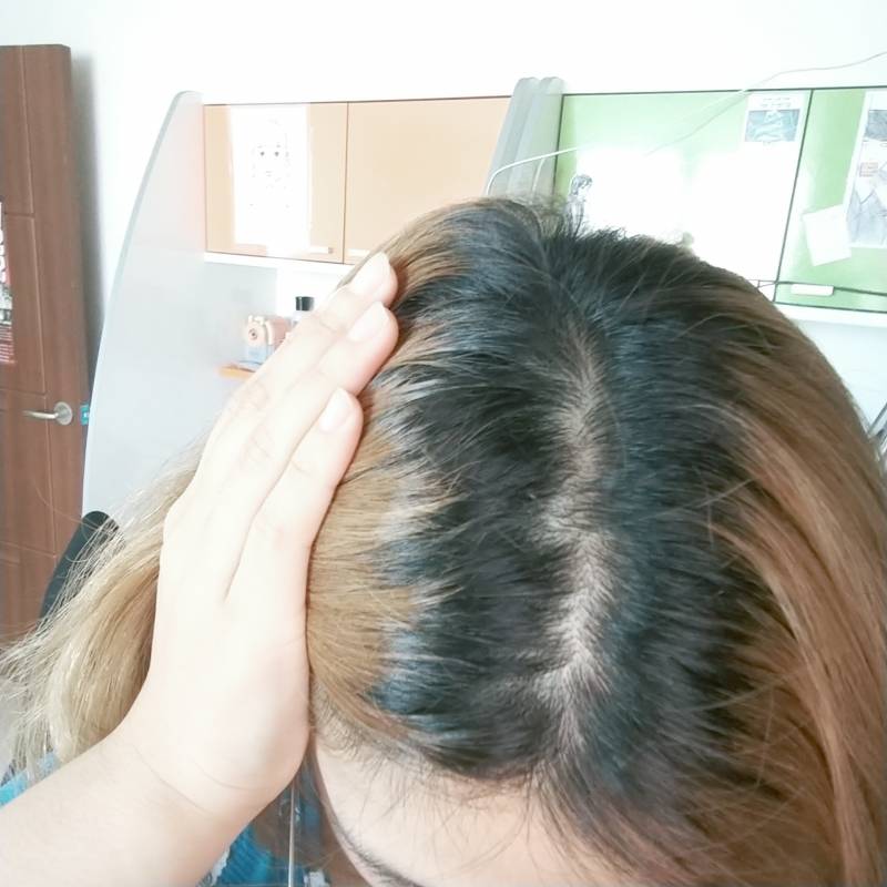 머리가 한달 2주동안 이만큼 자라면 | 인스티즈