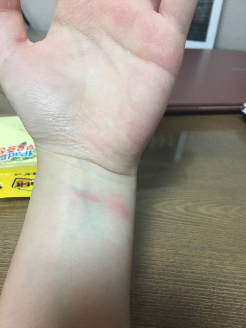 이거 자해 같아?? | 인스티즈