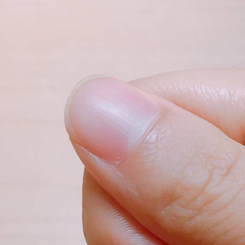 이게 손톱에 세로줄? 이 있는 거야 아니면 다들 그래? | 인스티즈