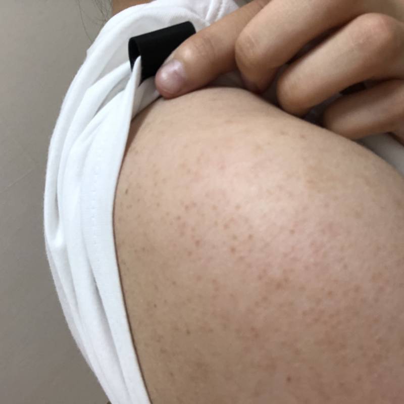 ㅎㅇㅈㅇ)호텔에 비치되있던 바디워시 사용한 담에 바로 이거 올라왔는데 뭐야ㅠㅠㅠ? | 인스티즈