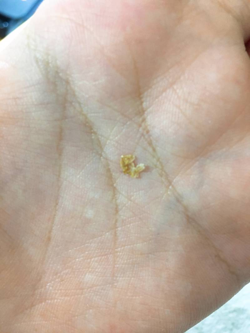 오왕 귀지나왔다!! (ㅎㅇㅈㅇ | 인스티즈