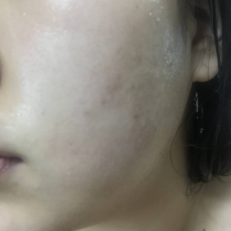 세럼 하나 바꿨는데 피부 이만큼 좋아지는거 실화냐,,, | 인스티즈