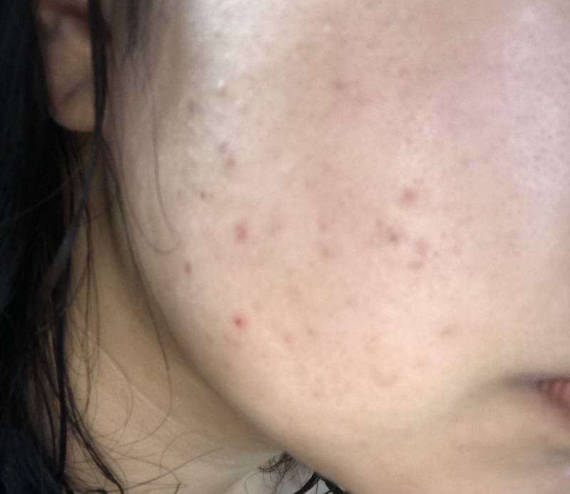 세럼 하나 바꿨는데 피부 이만큼 좋아지는거 실화냐,,, | 인스티즈