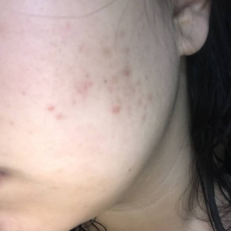 세럼 하나 바꿨는데 피부 이만큼 좋아지는거 실화냐,,, | 인스티즈