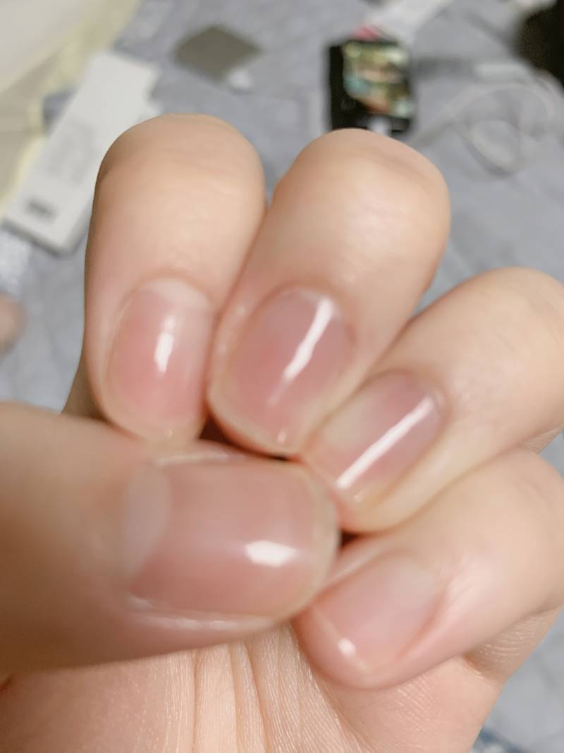 40 와진짜 대박이야 제발 좀 봐주라 진짜 소름..관리의 중요성 | 인스티즈