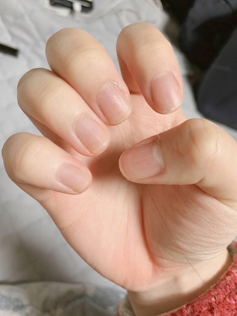 40 와진짜 대박이야 제발 좀 봐주라 진짜 소름..관리의 중요성 | 인스티즈