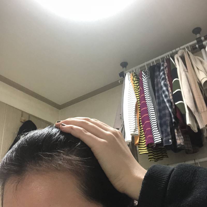 엠자 이마 스트레스 | 인스티즈