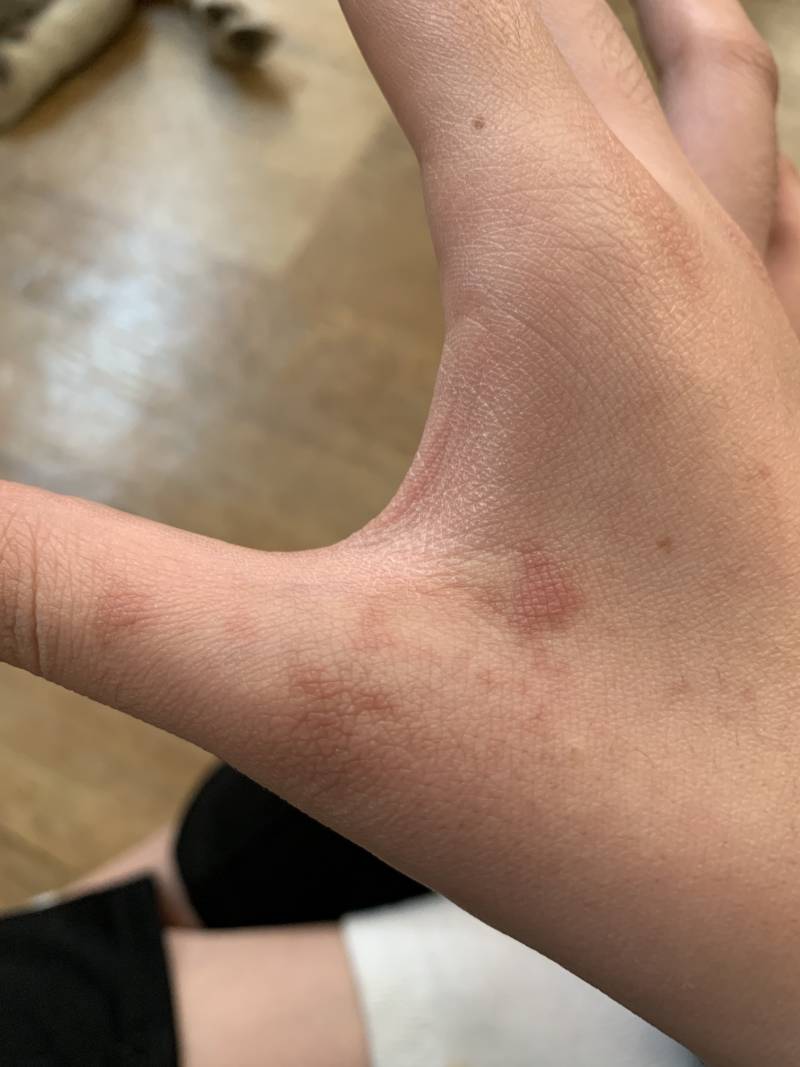 내 손이 왜이럴까? | 인스티즈