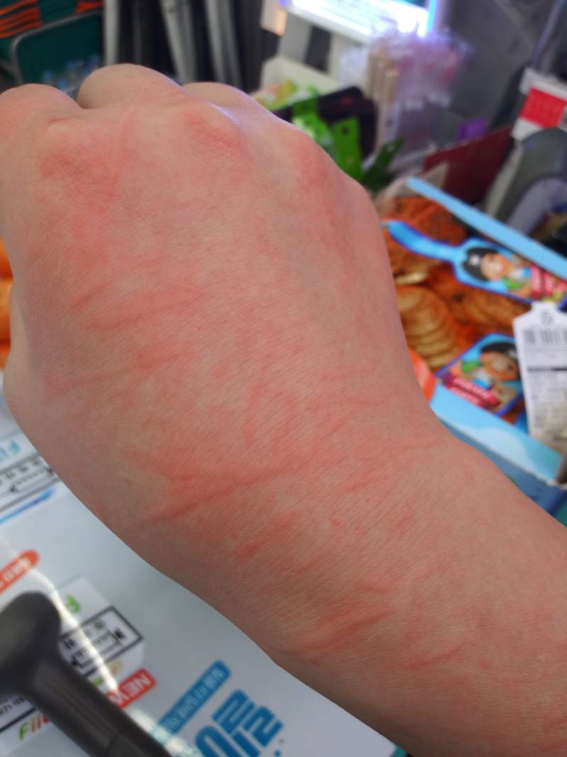 누가 할퀸 거 같지 | 인스티즈