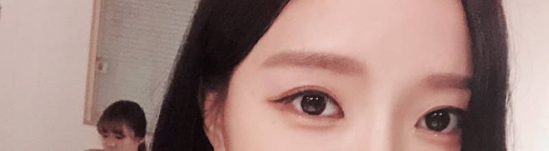 내눈에서 앞트임만하는거 어떻게생각해?40 | 인스티즈