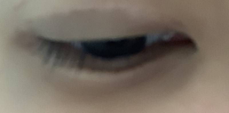 😭😭익들아 나 쌍수 망한 걸까 ㅠㅠ 4040 | 인스티즈