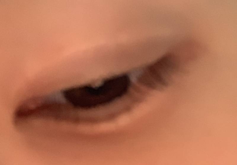 😭😭익들아 나 쌍수 망한 걸까 ㅠㅠ 4040 | 인스티즈