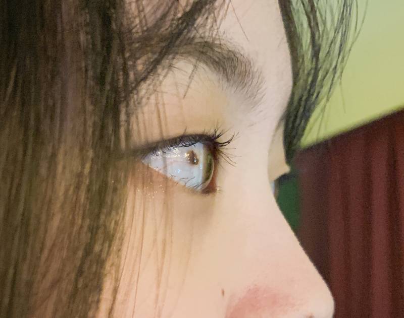 나 눈에 점있는데 사진 찍을 때마다 스트래스 받아 ㅠ ㅅㅜ | 인스티즈