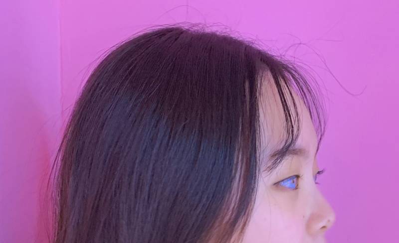 나 눈에 점있는데 사진 찍을 때마다 스트래스 받아 ㅠ ㅅㅜ | 인스티즈