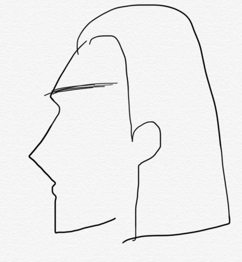 성형이나 보톡스 잘아는사람,,, | 인스티즈