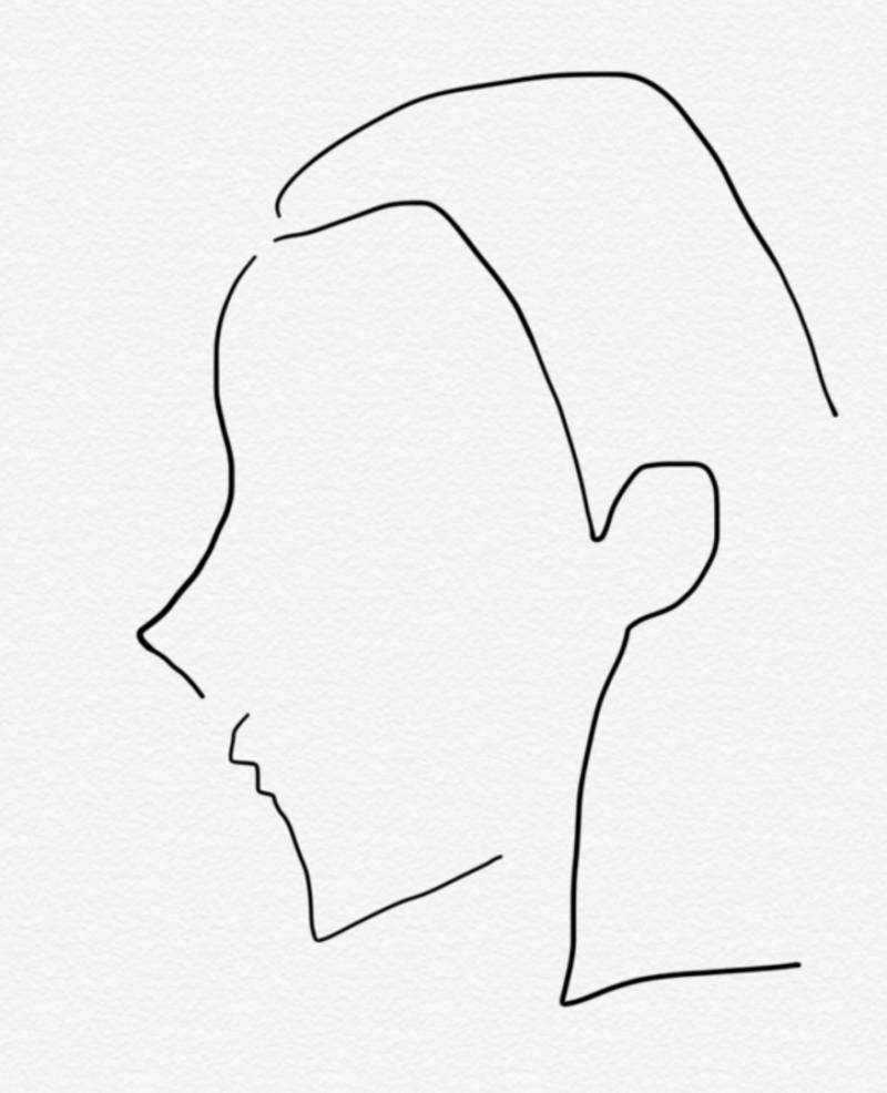 성형이나 보톡스 잘아는사람,,, | 인스티즈